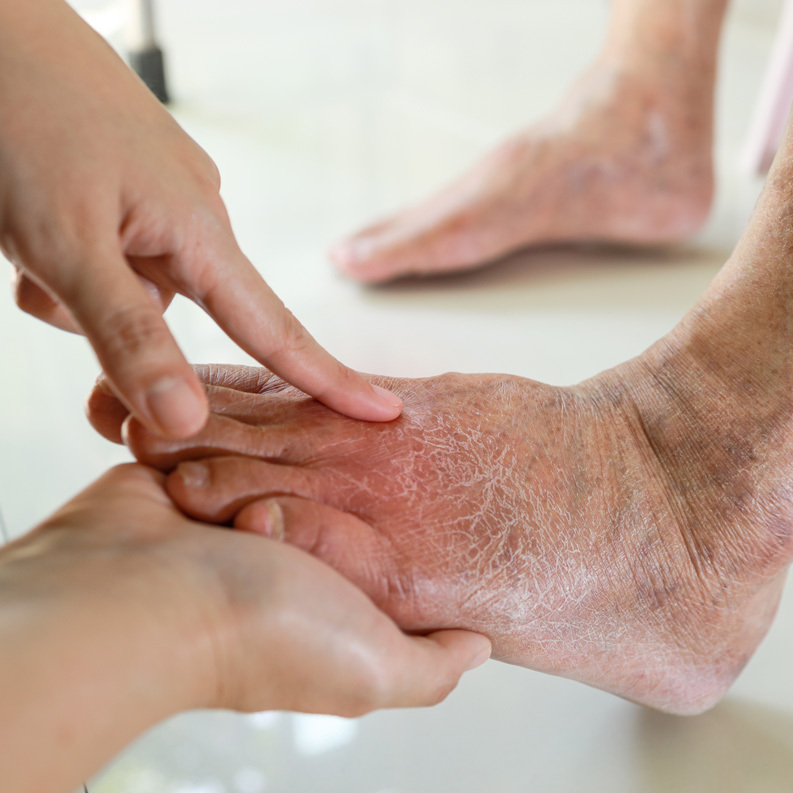 Podiatry Care for Diabetic Patients