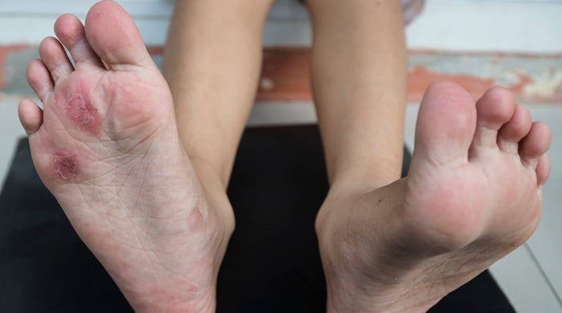 paed nail and skin condition