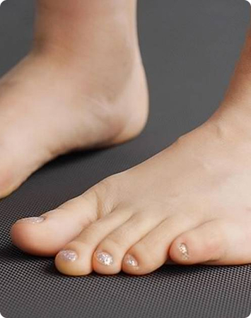 Curly Toe Syndrome