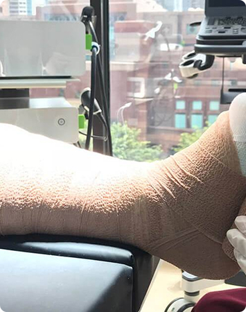 Venous Insufficiency, Stasis, and Ulceration