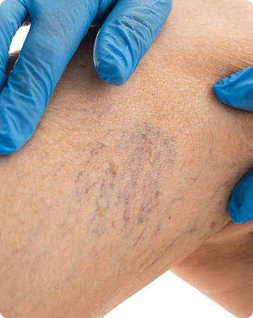 Who Sees a Vascular Doctor