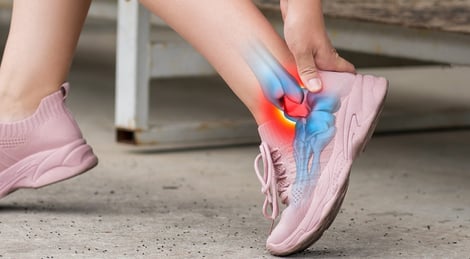 Foot & Ankle Arthritis: When to See a Podiatrist