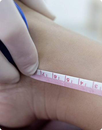 Leg Length Discrepancy