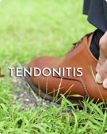 Peroneal Tendonitis
