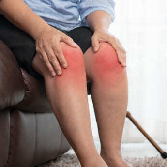 Often-affects-both-legs-1 