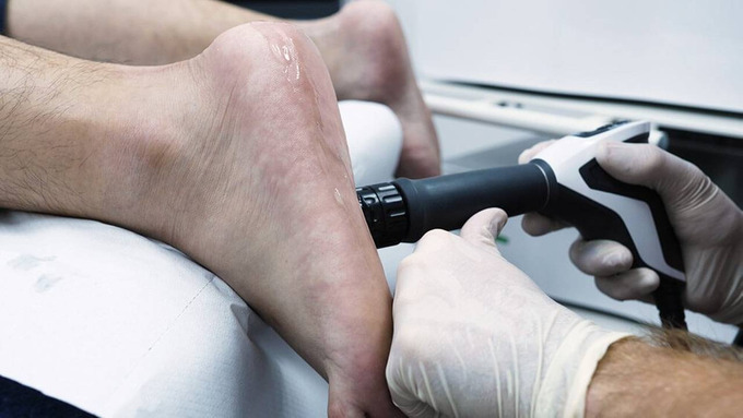 Plantar-Fasciitis-Treatment-On-Foot