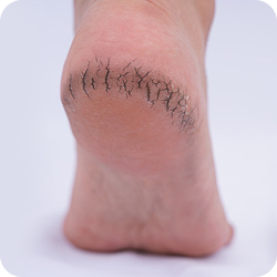 Sharp and stabbing pain like a knife in the heel