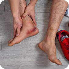 Symptoms-of-Ankle-Sprains-5