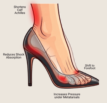 Increases Pressure under Metatarsals