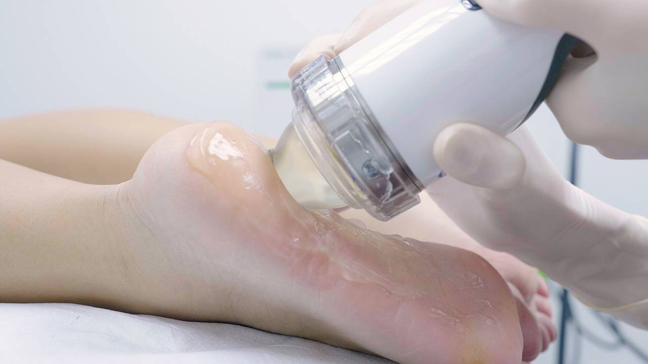 Arch Differences and Associated Problems | East Coast Podiatry Singapore