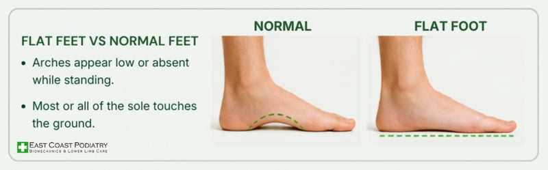 flat feet vs normal feet (East Coast Podiatry Singapore)