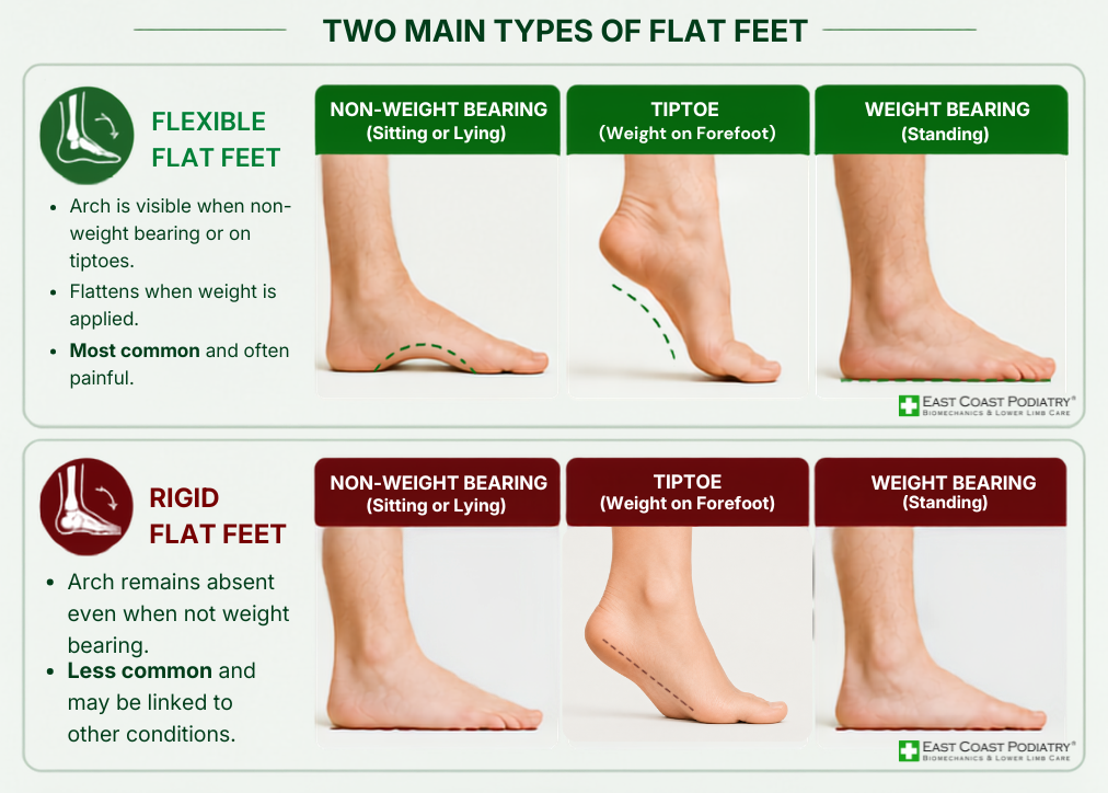 flexible flat feet vs rigid flat feet east coast podiatry singapore