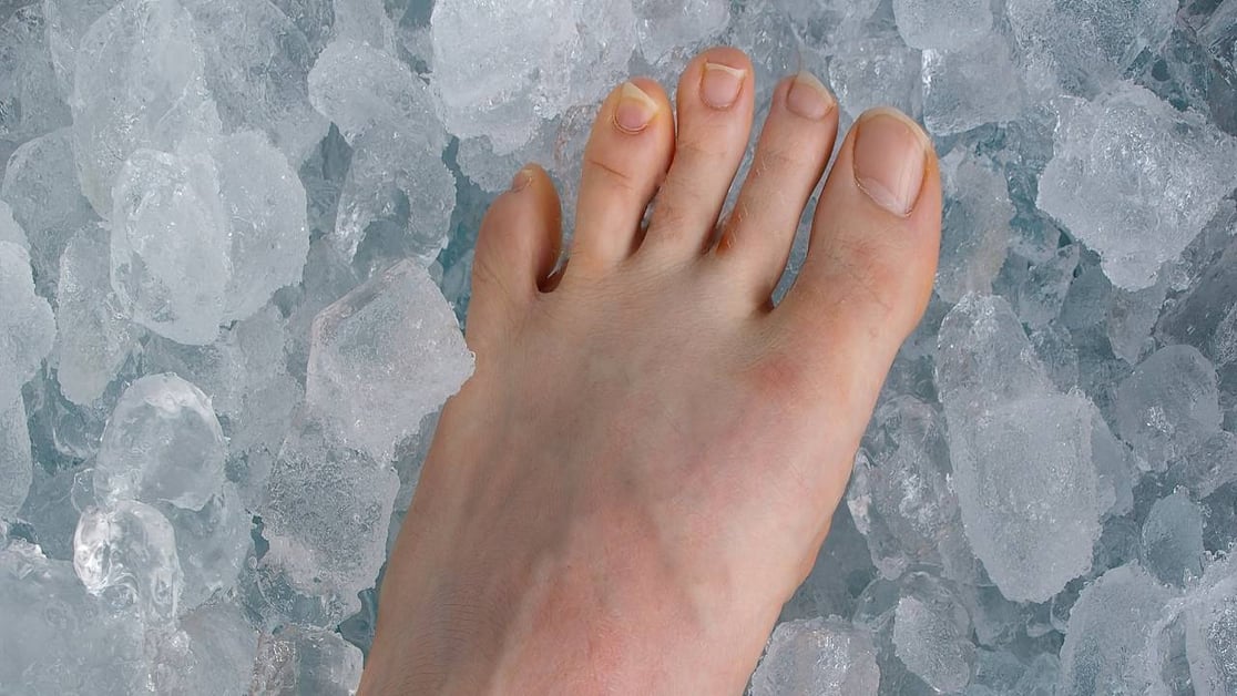 plantar-fascia-tear-image-2