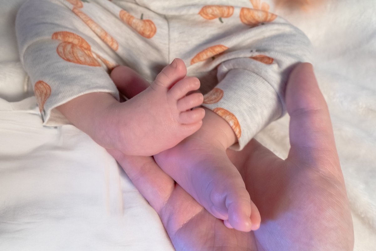 children-club-feet (2)