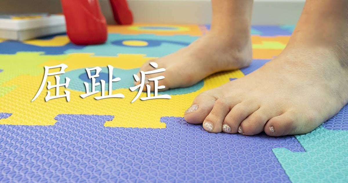 cn-curly-toes-thumbnail