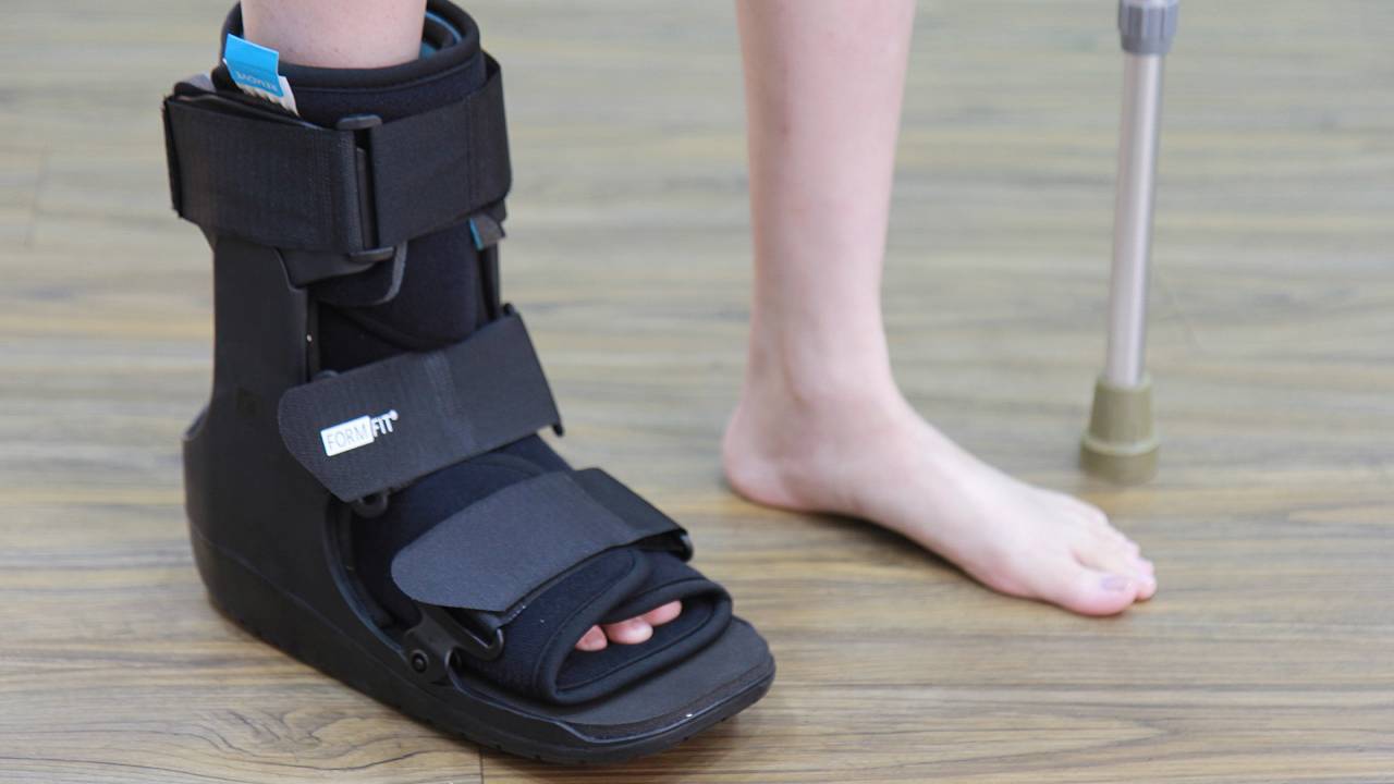 diabetic-foot-conditions-image-5