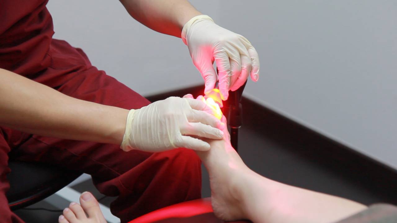 fungal-nail-treatment