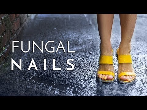 fungal-toenail-two-col