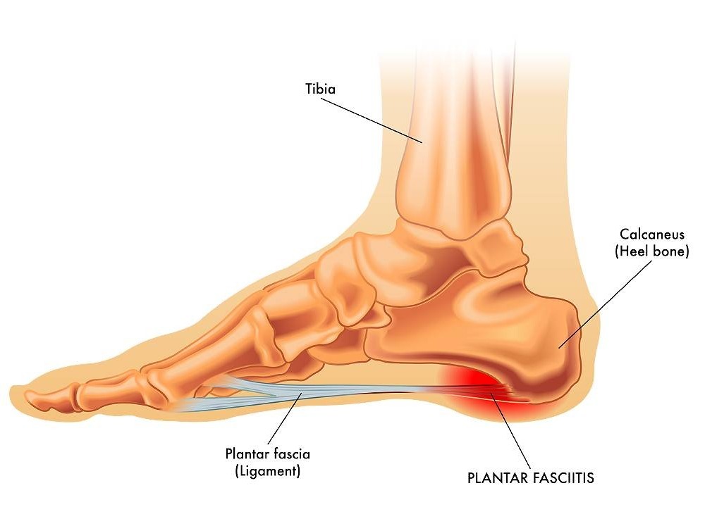 heel-pain-causes