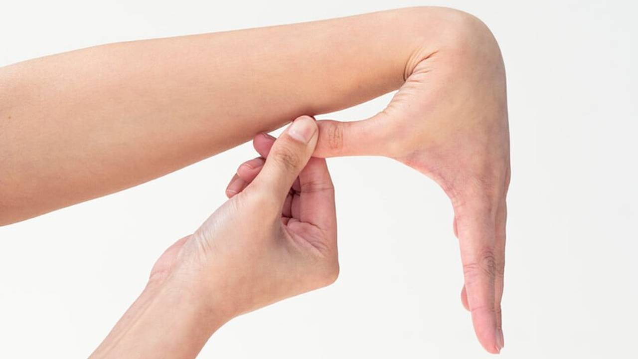 hypermobility-image-2