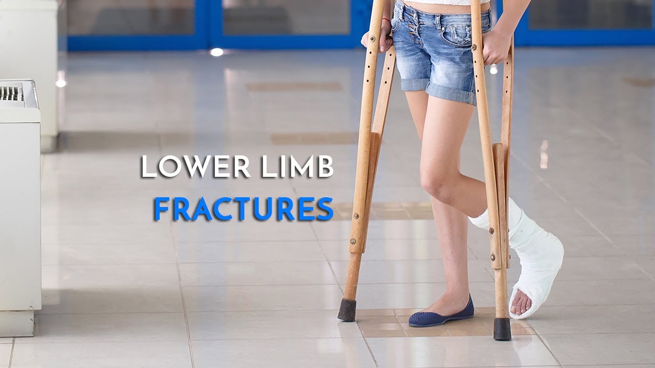 lower limb fractures