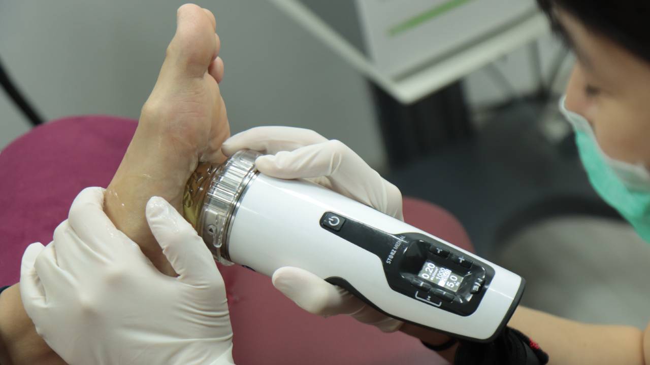 management-of-charcot-foot