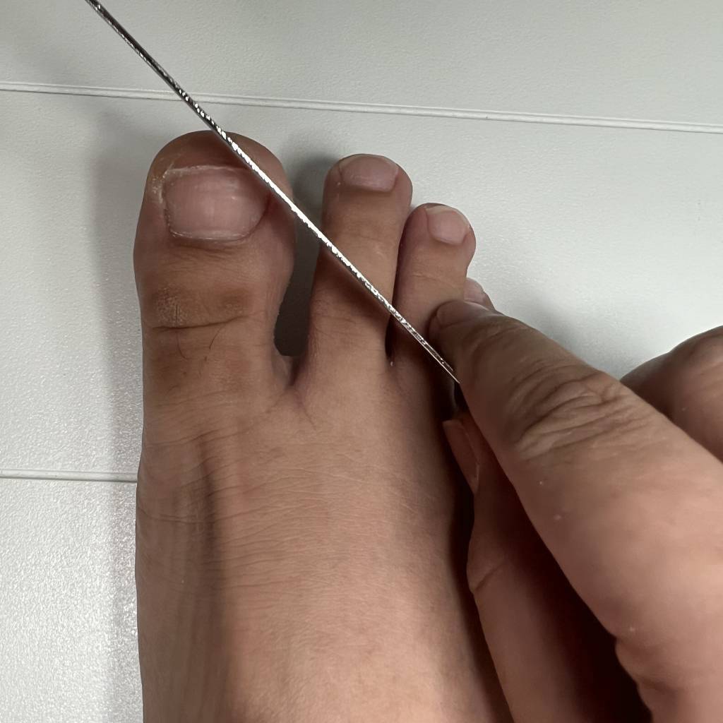 miconazole-lacquer-with-debridement-tool-usage-instruction-03