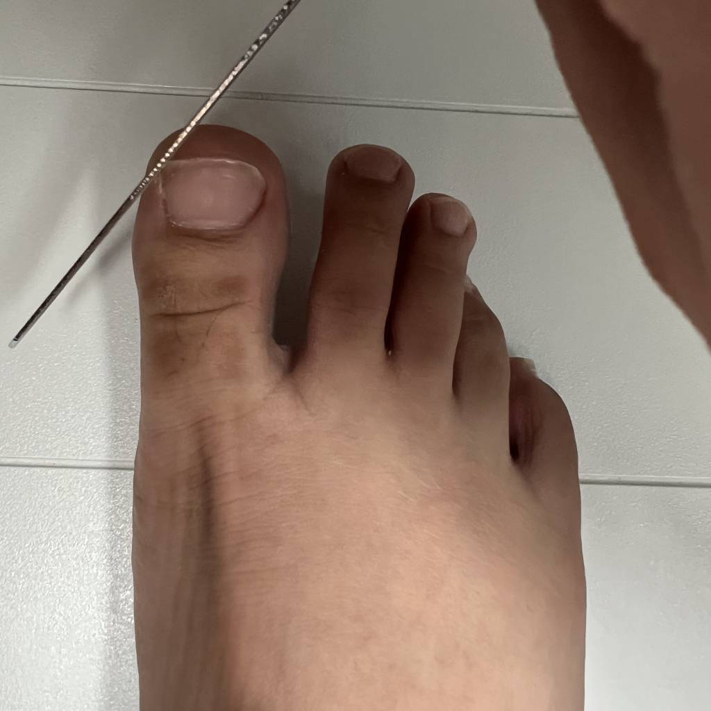 miconazole-lacquer-with-debridement-tool-usage-instruction-04