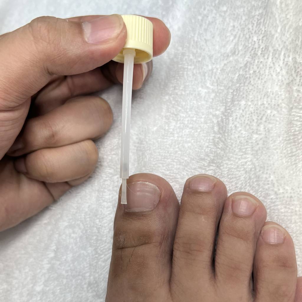 miconazole-lacquer-with-debridement-tool-usage-instruction-05