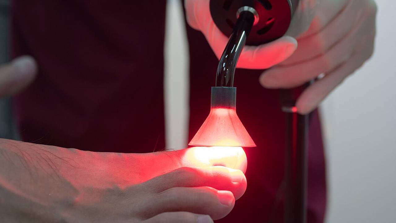 pact-light-therapy-fungus-warts-image-1