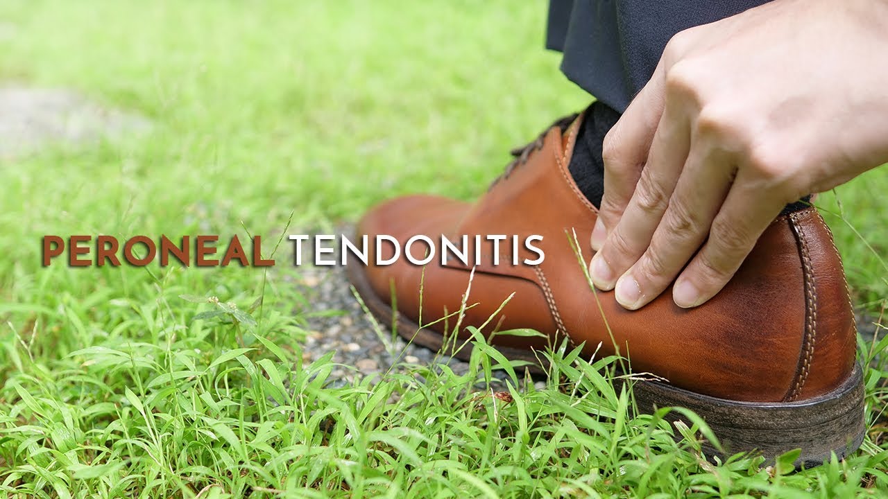 peroneal tendonitis thumbnail