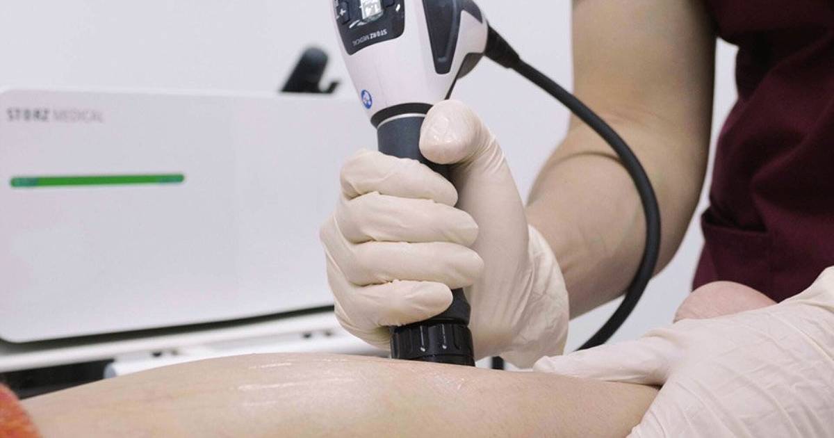 radial-shockwave-therapy-thumbnail