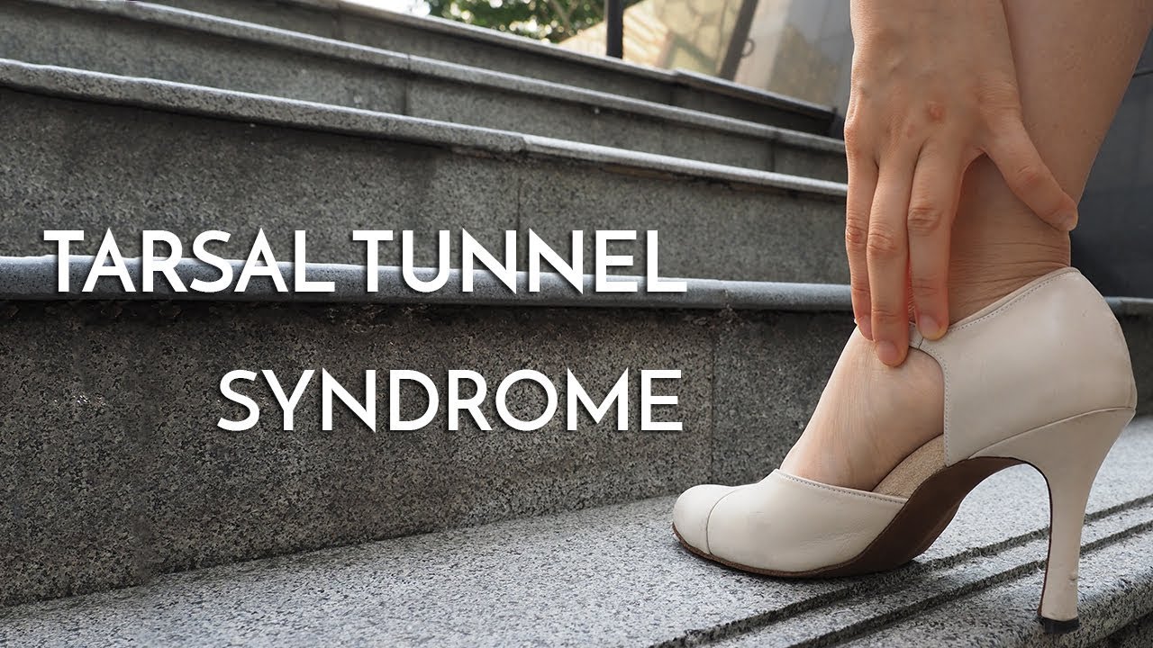 tarsal tunnel thumbnail