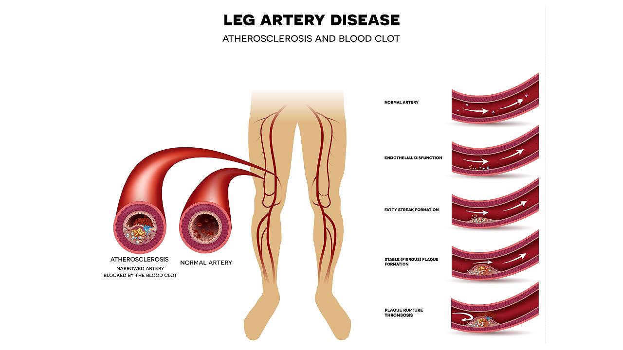 vascular-specialist-doctors-diagram