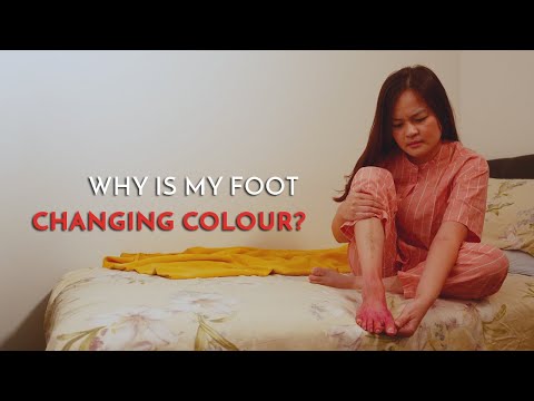 foot-changing-color