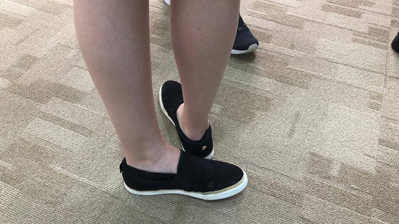 hypermobility-image-4