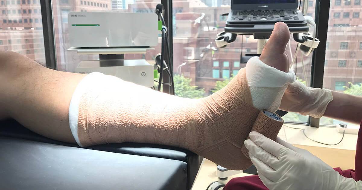 Venous Insufficiency, Stasis, and Ulceration | Singapore