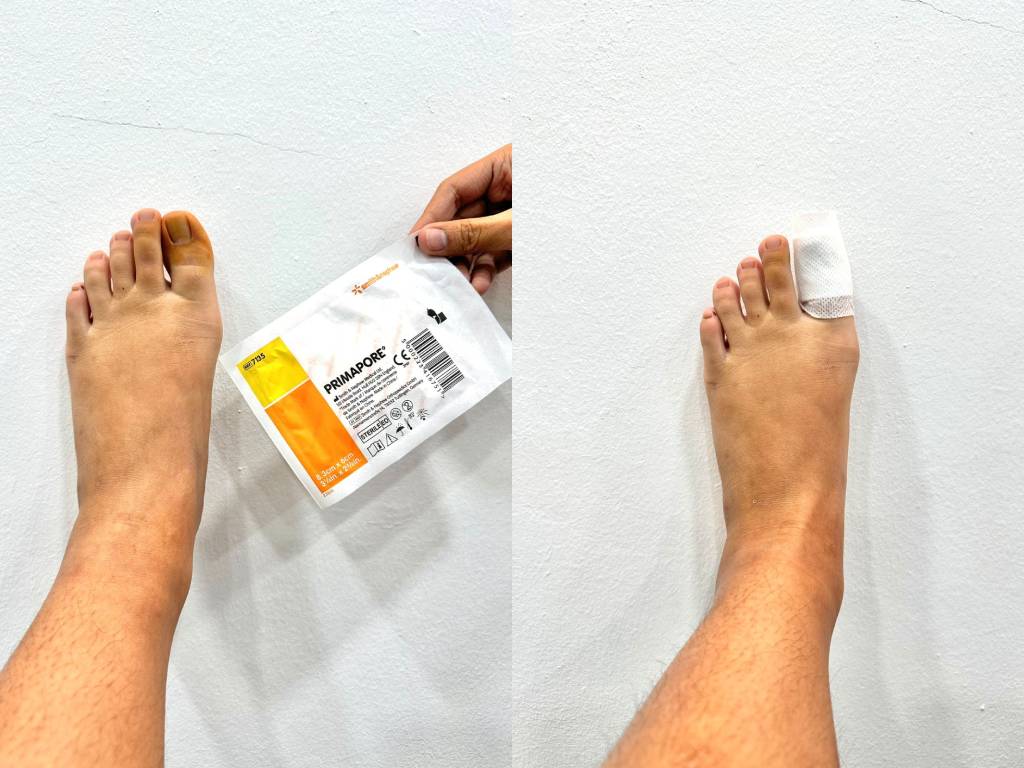 wound-care-usage-instruction-09