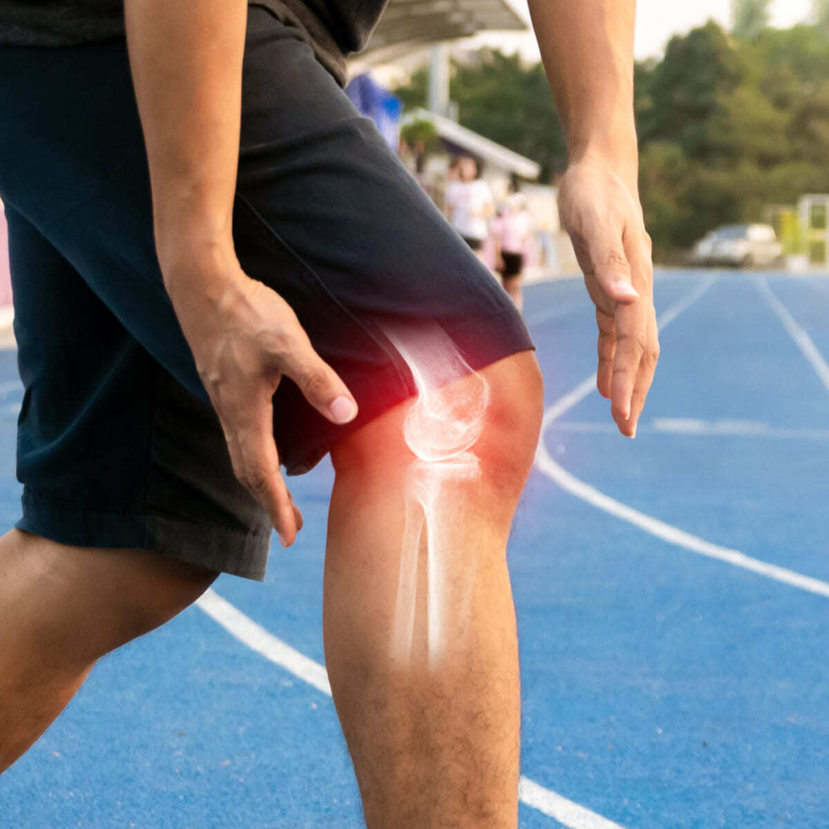 Patellar Tendonitis (1)