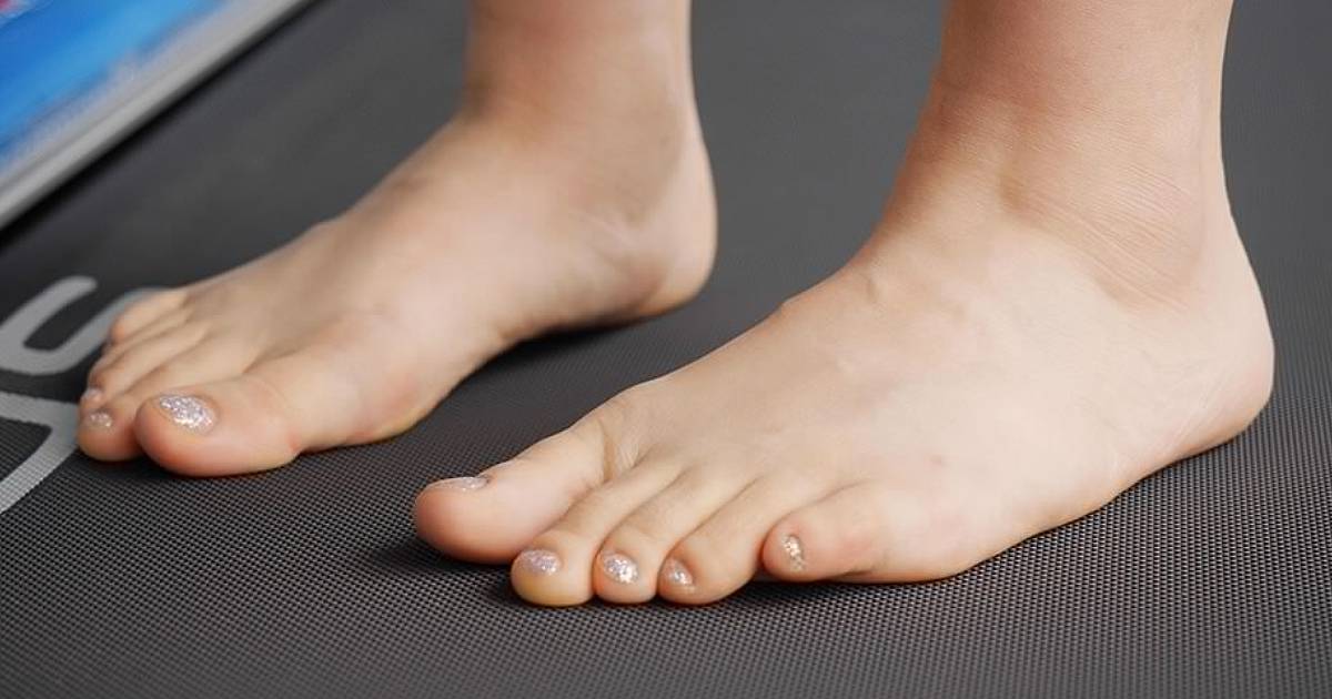 Curly Toe Syndrome