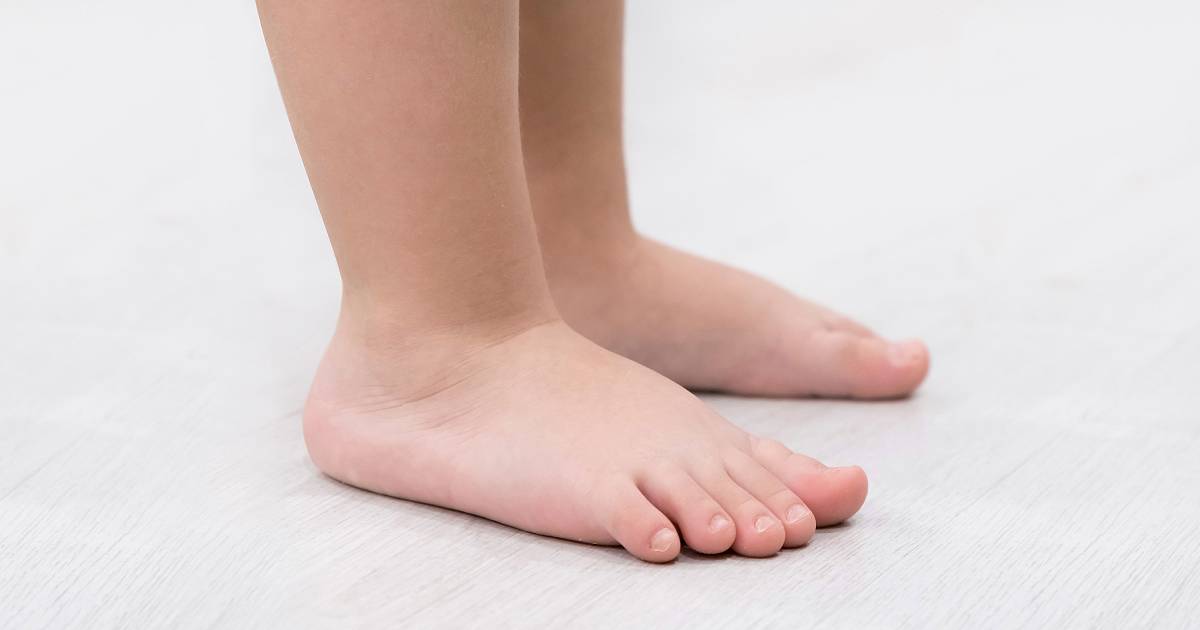 Flat Foot Child
